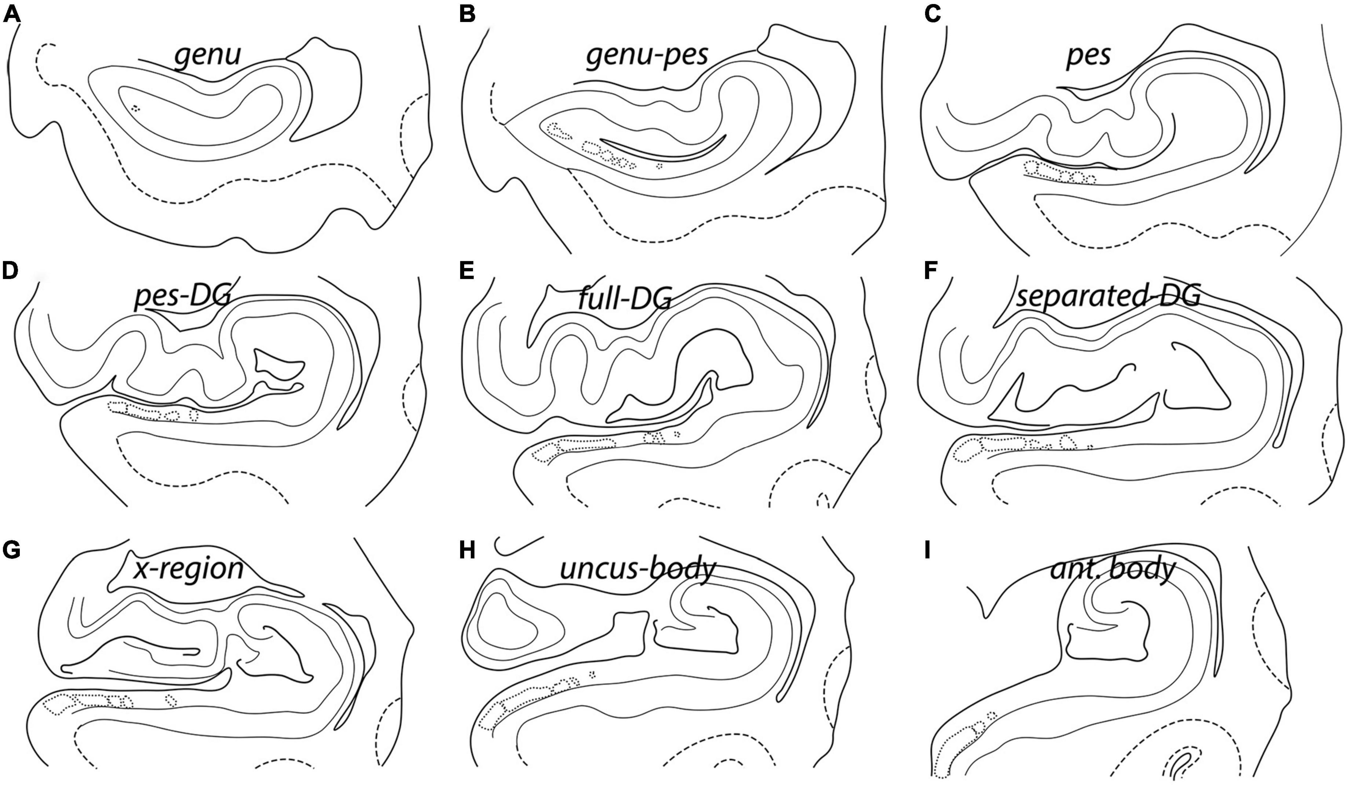 Pentad: A reproducible cytoarchitectonic protocol and its application to parcellation of the human hippocampus